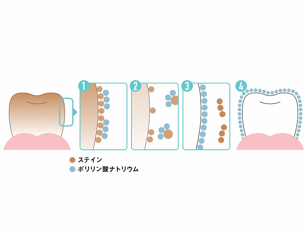 刺激が少なく漂白効果が高い