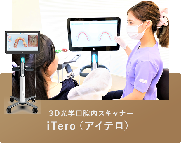 ３D光学口腔内スキャナー iTero（アイテロ）