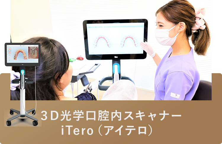 ３D光学口腔内スキャナー iTero（アイテロ）