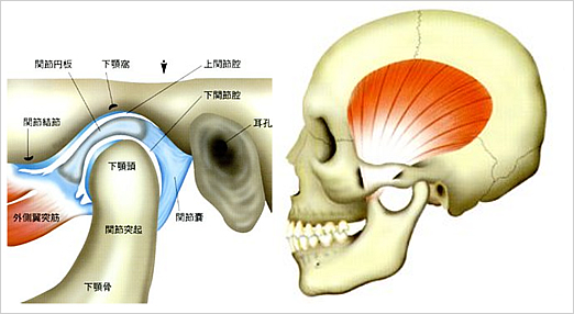 顎関節症