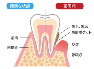 博多駅歯周病